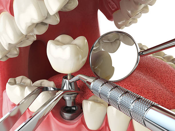 Best Walk-In Emergency Dentist in Holts Summit, MO