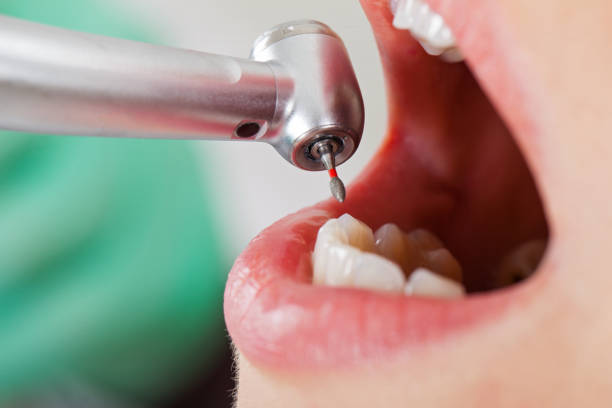 Best Emergency Broken Tooth Repair in Holts Summit, MO